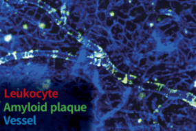 Leukocyte (1)