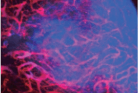 Neutrophil (1)